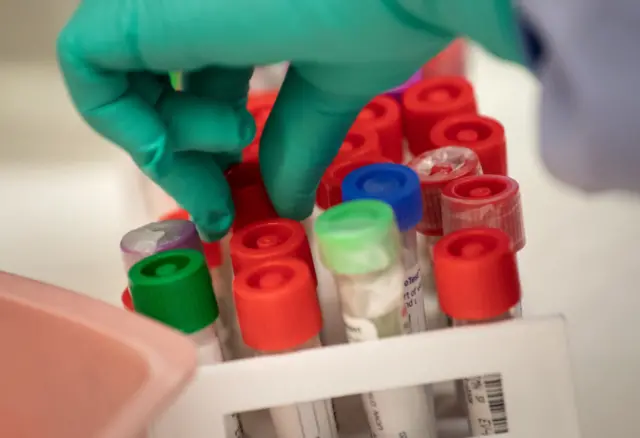 A medical Laboratory scientist tests vials of samples for coronavirus