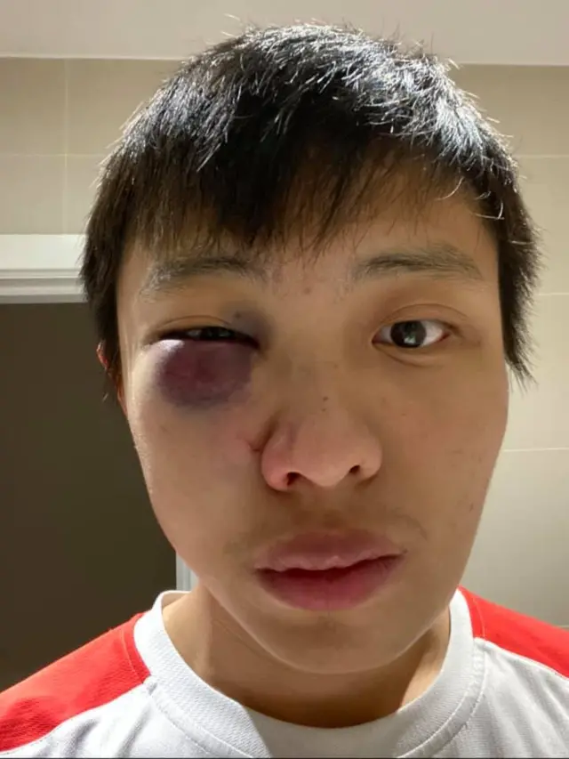 Jonathan Mok, who says he was assaulted in London
