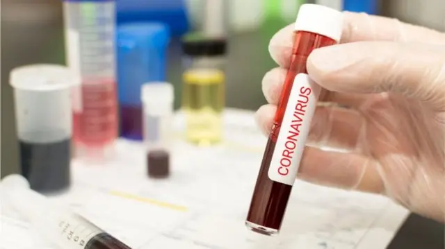 Coronavirus test