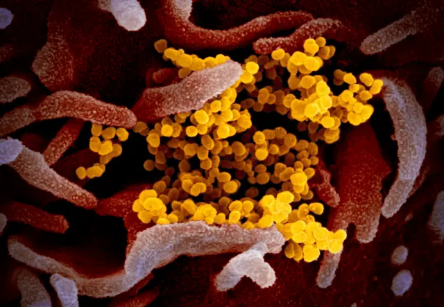 Microscopic image of SARS-CoV-2 virus (yellow) emerging from the surface of cells