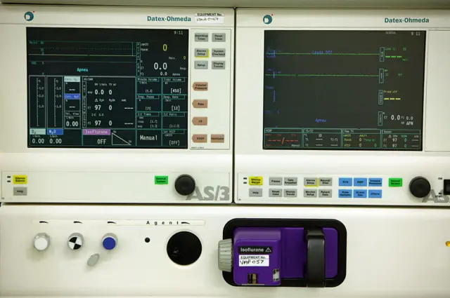 ventilator monitor in intensive care unit. UK (