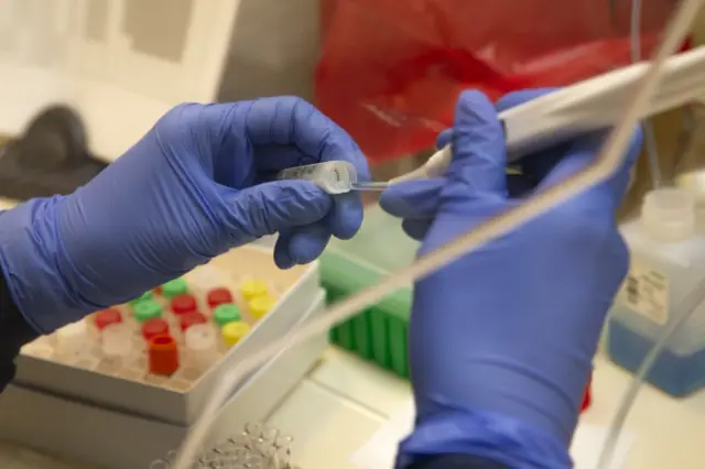 Medical laboratory scientist runs a clinical test in the Immunology lab at UW Medicine