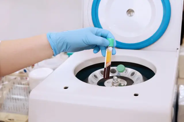 Tubes of blood in a centrifuge