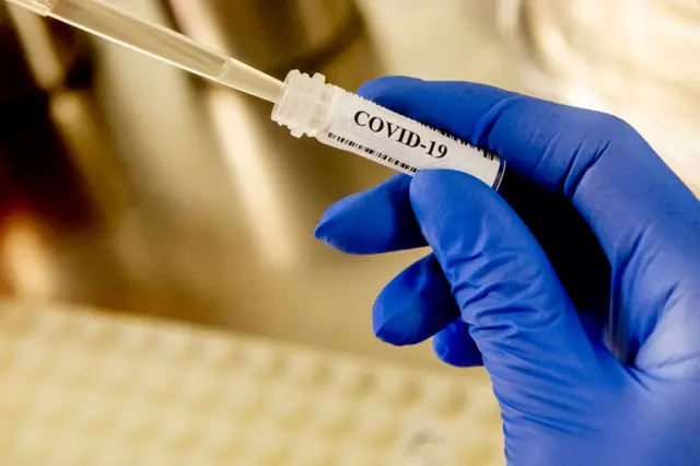 A Covid-19 test