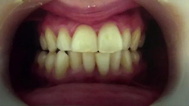 Teeth