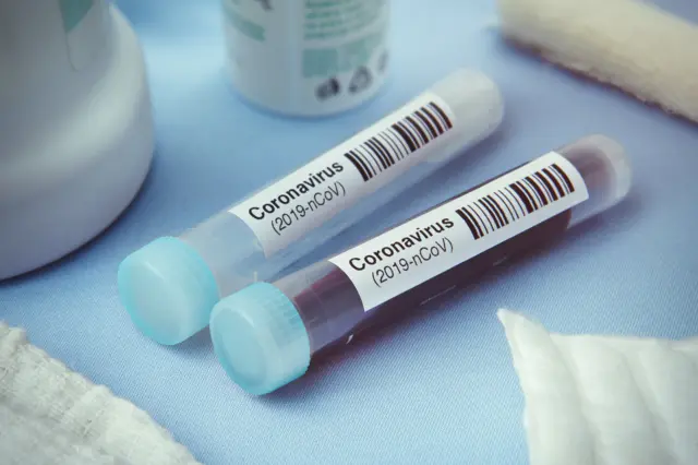 Coronavirus test