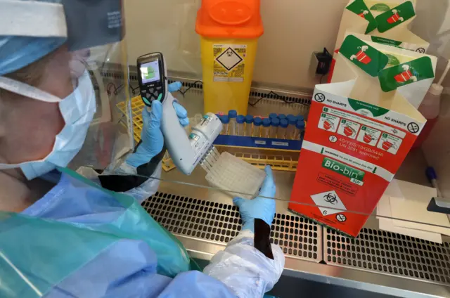 Coronvirus testing at the Queen Elizabeth University Hospital in Glasgow