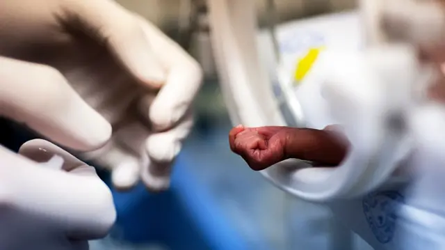 A newborn baby in a hospital in Bloemfontein, South Africa.