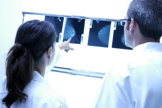 Radiographers study cancer screening results