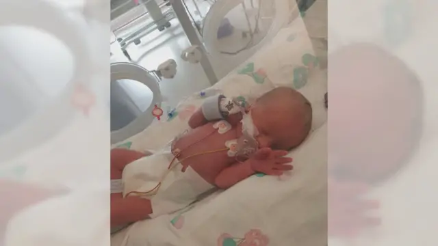 Noah McGee was born eight weeks premature