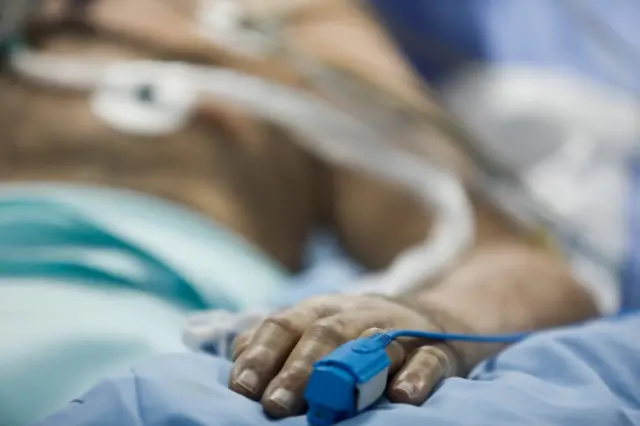 The hand of a Covid-19 patient in an intensive care unit in Athens, Greece (file photo)