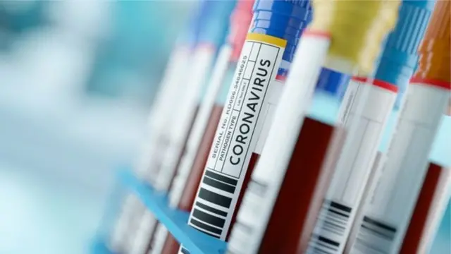 Coronavirus swabs