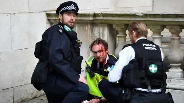 A police officer receives medical attention after police clash with demonstrators on Whitehall during a Black Lives Matter protest in London