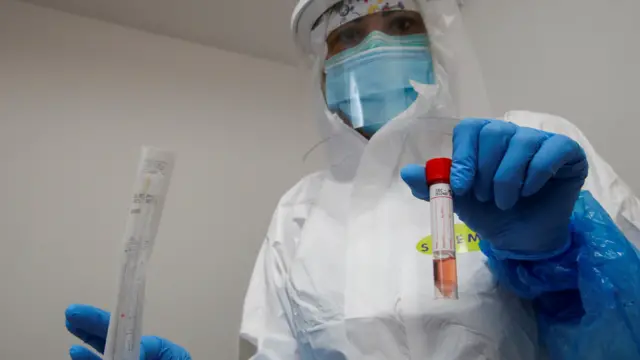 A healthcare worker holds a test tube after administering a nasal swab in Italy