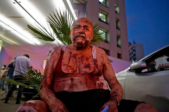 A wounded man receives help outside a hospital following an explosion in the Lebanese capital Beirut on August 4, 2020