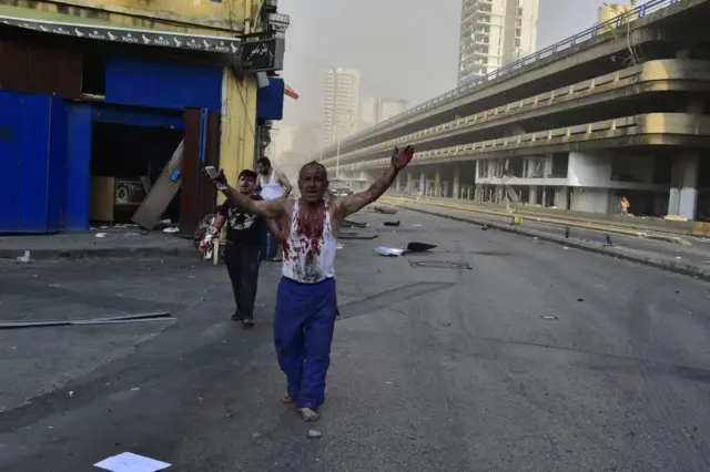 Wounded people are seen near the site after a fire at a warehouse with explosives at the Port of Beirut led to massive blasts in Beirut