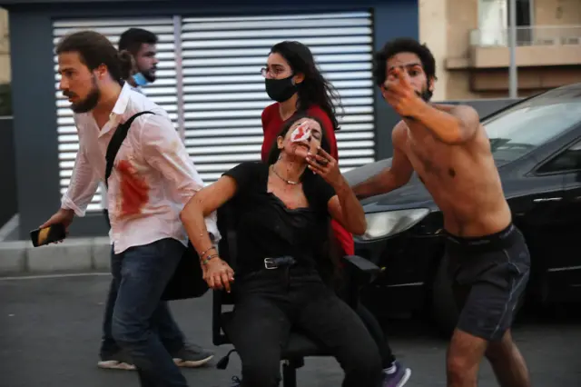 Wounded people are pictured outside a hospital following an explosion in the Lebanese capital Beirut