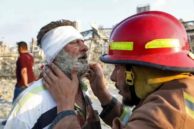 A wounded man is checked by a fireman near the scene of an explosion in Beirut on August 4, 2020