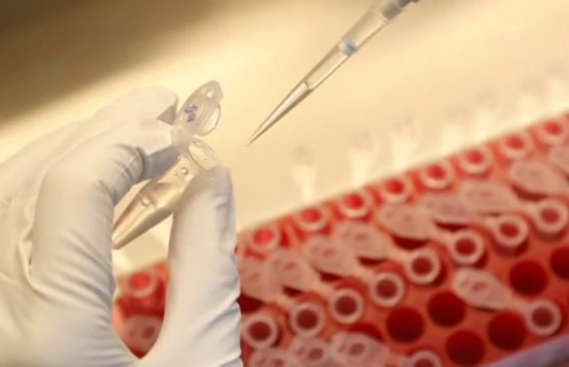 A scientist dilutes samples during the research and development of a coronavirus vaccine in St Petersburg, Russia. File photo