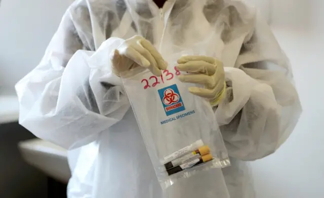 A health worker holds a Covid-19 sample collection kit from a volunteer in a vaccine trial in South Africa (file photo)