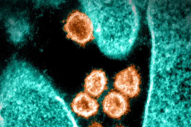 Sars-CoV-2 virus that causes Covid-19, viewed under a microscope.