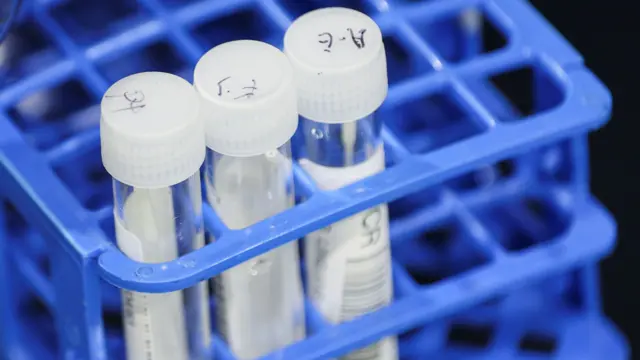 A tray of three vials containing PCR swab tests.