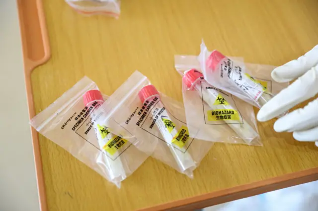 Swabs collected in a laboratory in Shenyang, China