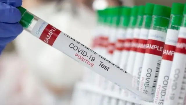 Test tubes labelled "COVID-19 Test positive"