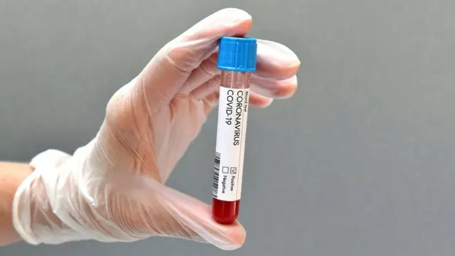 The test for antibodies is a blood sample