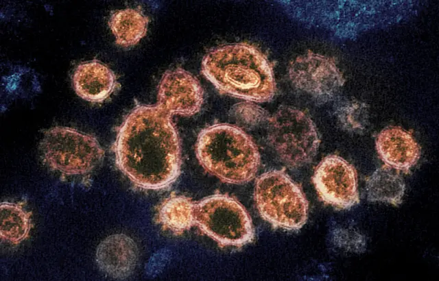 The Covid-19 strain of coronavirus