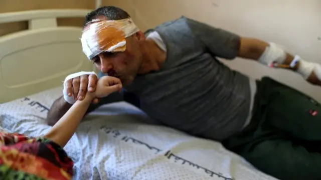 Image shows , Riyad Eshkuntana, who was pulled from the rubble along with his six-year-old daughter, Suzy, in Gaza.