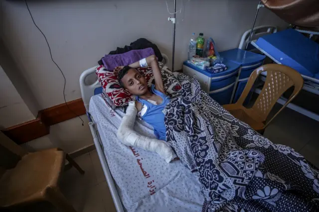 A Palestinian boy injured in Israeli air strikes lies Gaza City's hospital. Photo: 18 May 2021