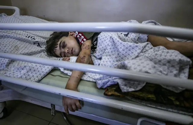 A Palestinian boy injured in Israeli air strikes is treated in hospital in Gaza City