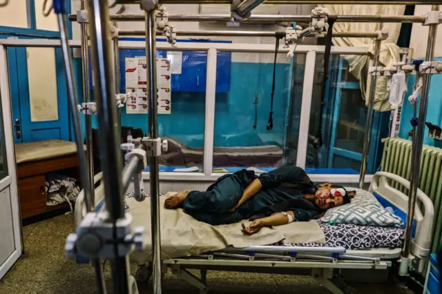 A wounded patient lays in the recovery unit at Wazir Akbar Khan Hospital. in Kabul,