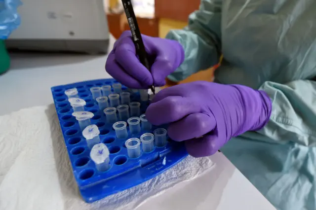 A health official works in the laboratory extraction room of the Institute of Lassa Fever Research and Control in Nigeria