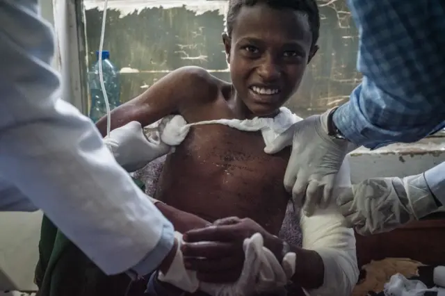 Injured residents in Togoga, a village about 20km west of Mekele, where an alleged airstrike hit a market leaving an unknown number of casualties, receives medical treatments at the Ayder referral hospital in Mekele, the capital of Tigray region, Ethiopia, on June 23, 2021.