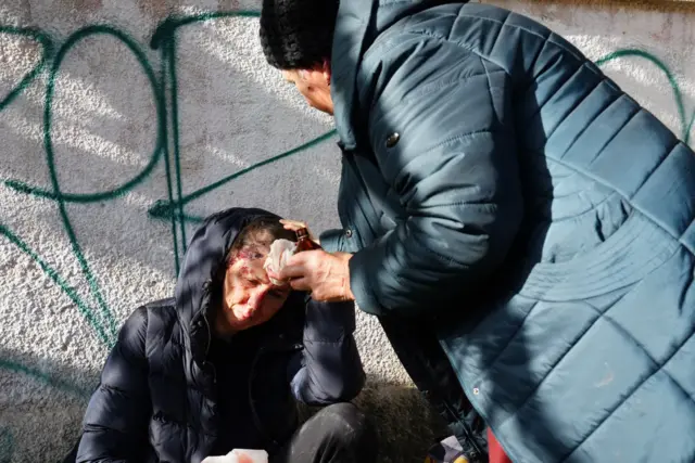 Woman being treated for head wounds