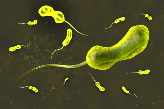 Vibrio cholerae bacterium which causes cholera disease