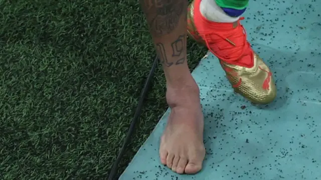 Neymar with a swollen left ankle