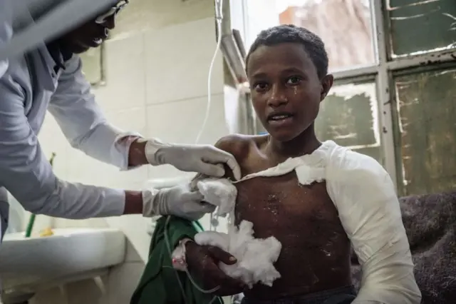 A Togoga injured residents, a village about 20km west of Mekele, where an alleged airstrike hit a market leaving an unknown number of casualties, receives medical treatments at the Ayder referral hospital in Mekele, the capital of Tigray region, Ethiopia, on June 23, 2021