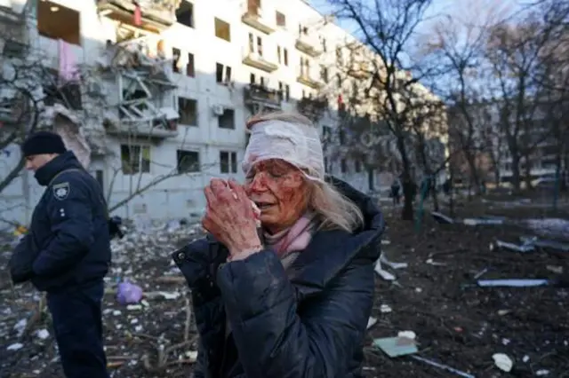 A woman is wounded after an airstrike damaged an apartment complex in city of Chuhuiv, Kharkiv Oblast, Ukraine