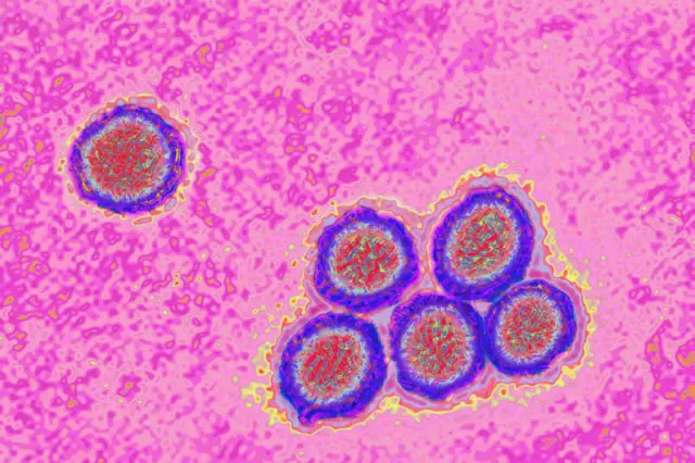 Flavivirus