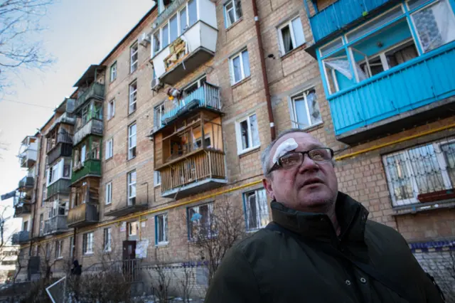 An injured man stands near his destroyed home in Kyiv