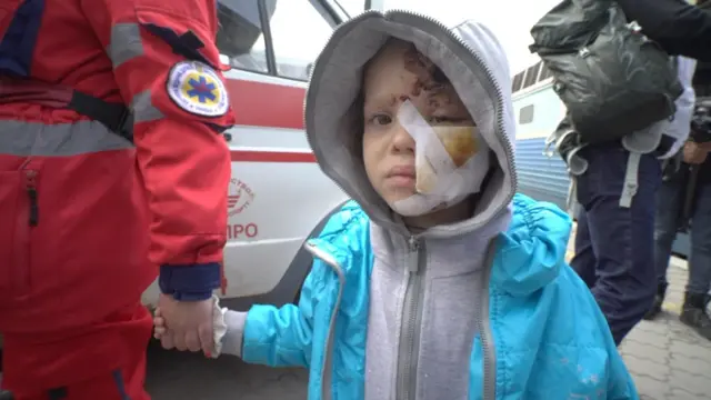 Child with facial injuries is escorted by medical personnel