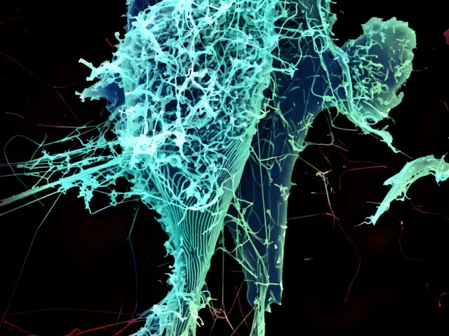 String-like Ebola virus particles are shedding from an infected cell in this electron micrograph