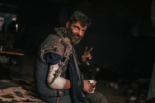 A wounded Azov fighter making a peace symbol