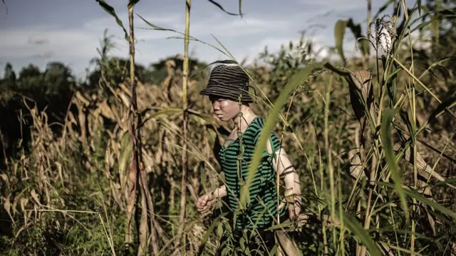 A person with albinism in Malawi - archive shot