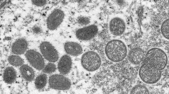 Monkeypox virus particles