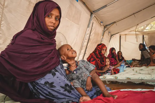 Kadija (23) and her son Kayruya share a light moment in the Inpatient Therapeutic Feeding centre tent.