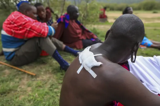 A Tanzanian Maasai man, who allegedly was shot in his back by Tanzanian security forces, shows his wounds during an interview